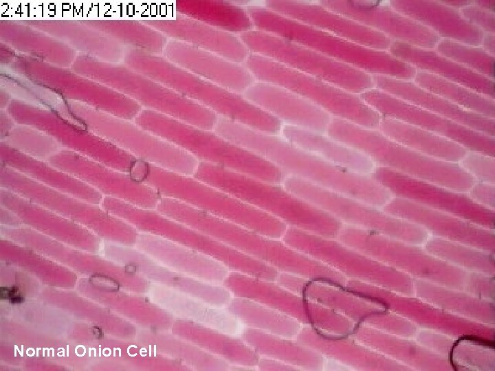 Normal Onion Cell 
