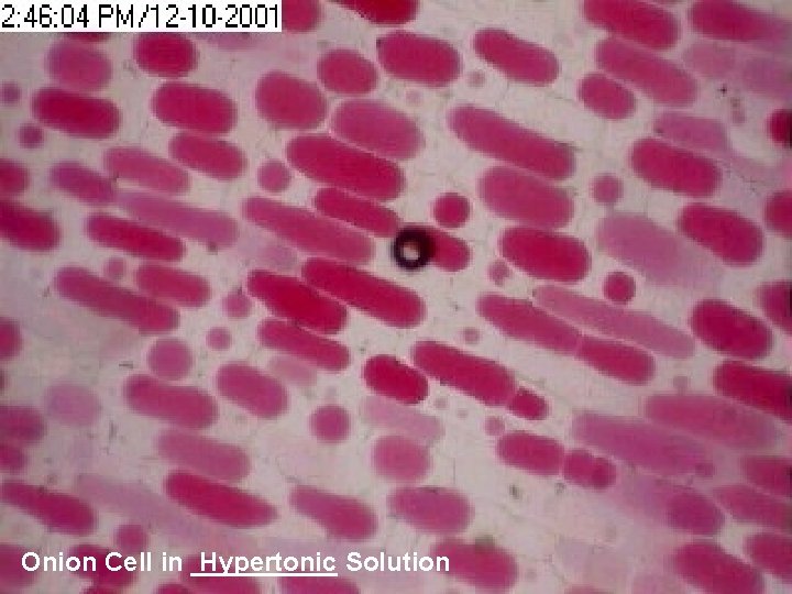 Onion Cell in _____ Hypertonic Solution 