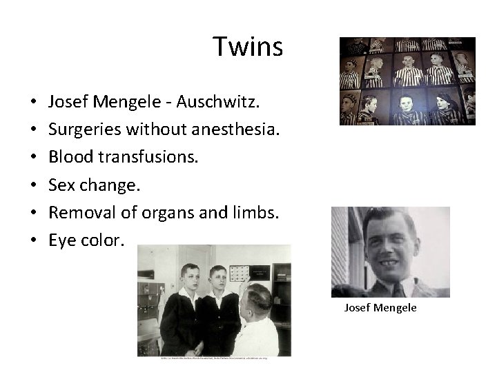 Twins • • • Josef Mengele - Auschwitz. Surgeries without anesthesia. Blood transfusions. Sex
