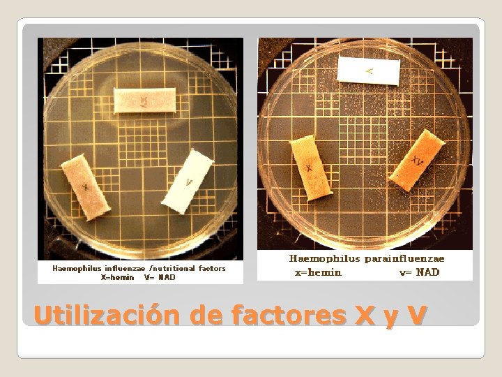 Utilización de factores X y V 