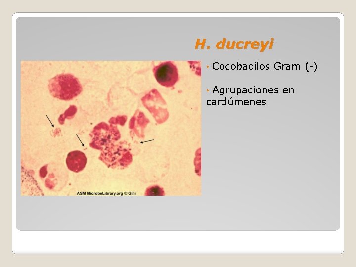 H. ducreyi • Cocobacilos Gram (-) Agrupaciones en cardúmenes • 