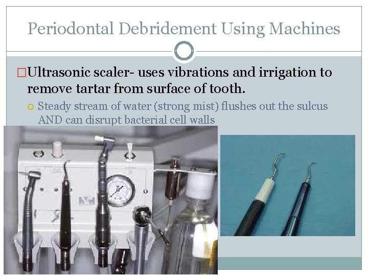 Periodontal Debridement Using Machines �Ultrasonic scaler- uses vibrations and irrigation to remove tartar from