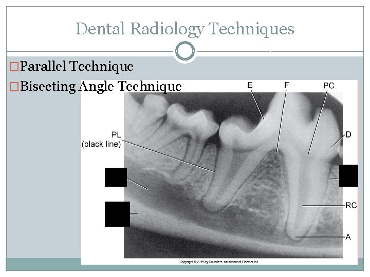 Dental Radiology Techniques �Parallel Technique �Bisecting Angle Technique 