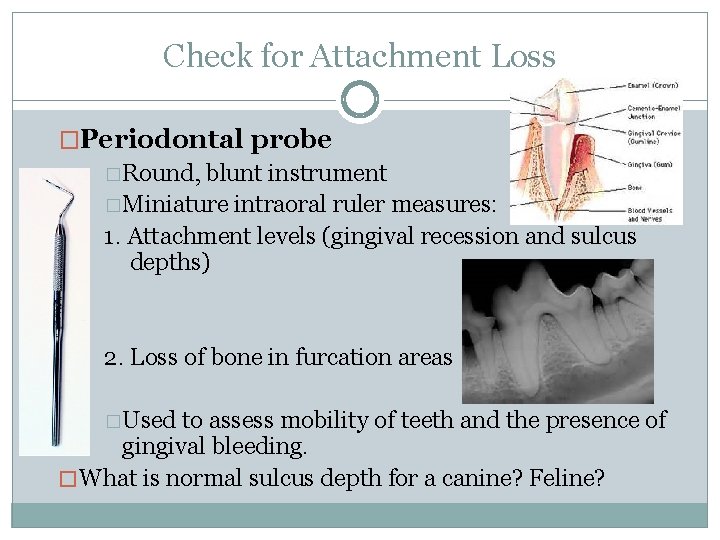 Check for Attachment Loss �Periodontal probe �Round, blunt instrument �Miniature intraoral ruler measures: 1.