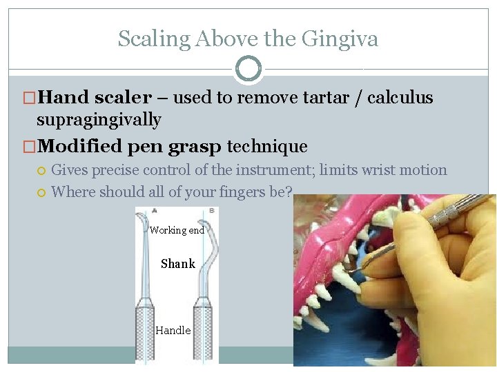 Scaling Above the Gingiva �Hand scaler – used to remove tartar / calculus supragingivally