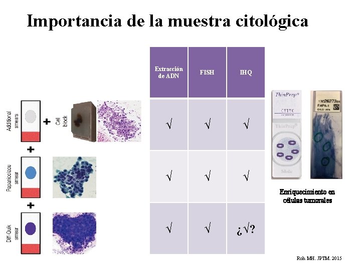 Importancia de la muestra citológica Extracción de ADN FISH IHQ √ √ √ Enriquecimiento