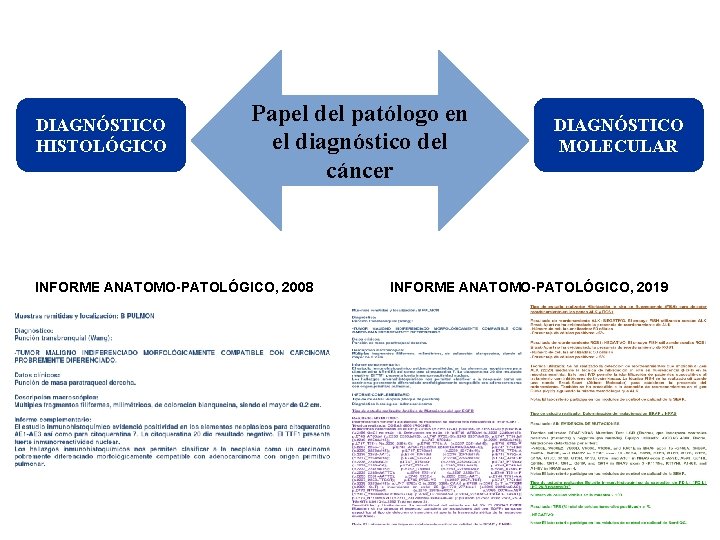 DIAGNÓSTICO HISTOLÓGICO Papel del patólogo en el diagnóstico del cáncer INFORME ANATOMO-PATOLÓGICO, 2008 DIAGNÓSTICO