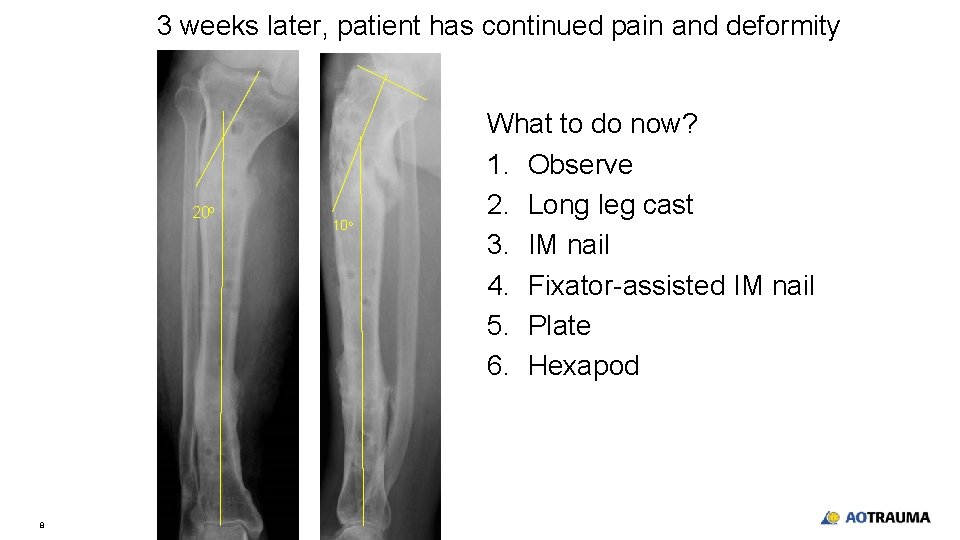 3 weeks later, patient has continued pain and deformity 20 o 8 10 o