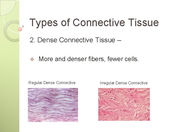 Types of Connective Tissue 2. Dense Connective Tissue – v More and denser fibers,