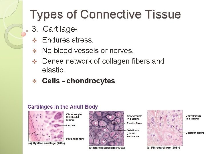 Types of Connective Tissue 3. Cartilage. Endures stress. v No blood vessels or nerves.