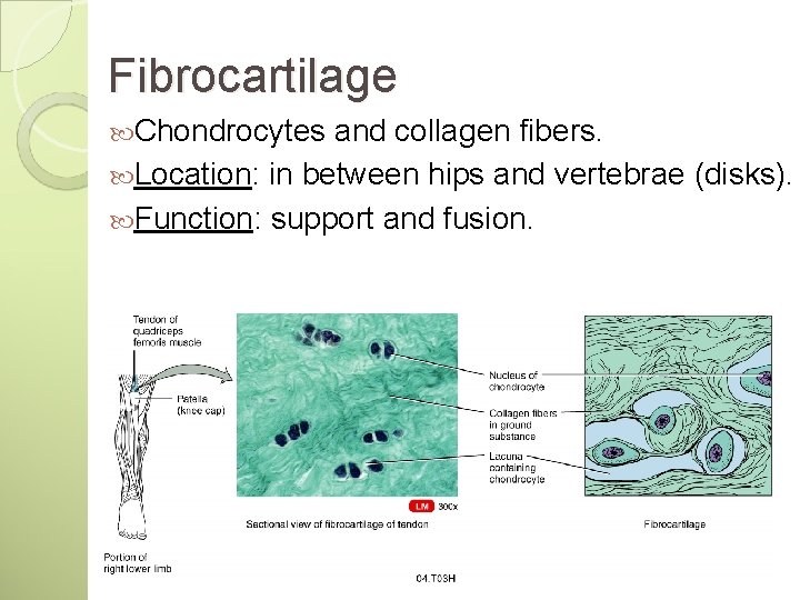 Fibrocartilage Chondrocytes and collagen fibers. Location: in between hips and vertebrae (disks). Function: support