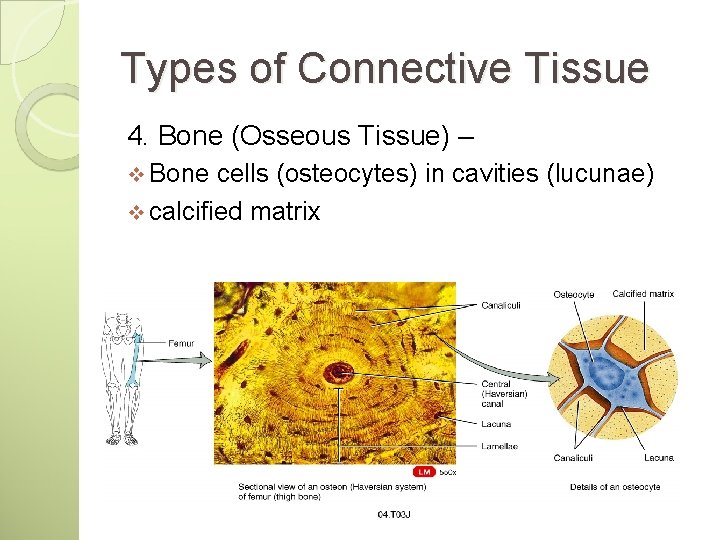 Types of Connective Tissue 4. Bone (Osseous Tissue) – v Bone cells (osteocytes) in