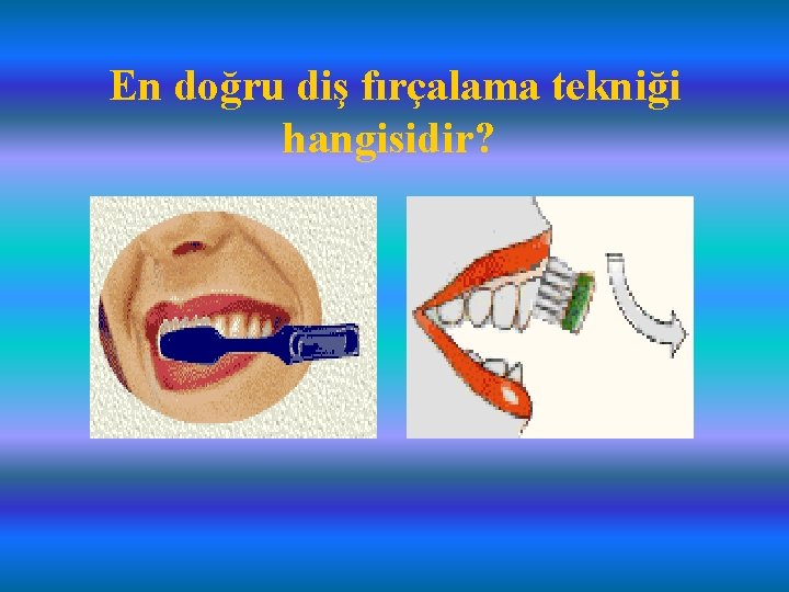 En doğru diş fırçalama tekniği hangisidir? 
