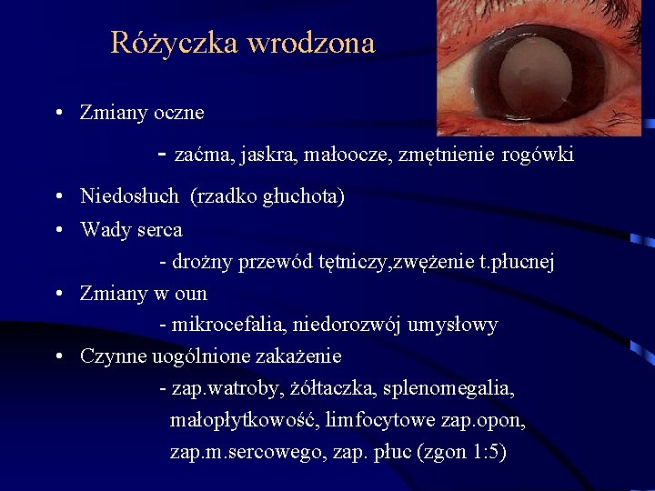 Różyczka wrodzona • Zmiany oczne - zaćma, jaskra, małoocze, zmętnienie rogówki • Niedosłuch (rzadko