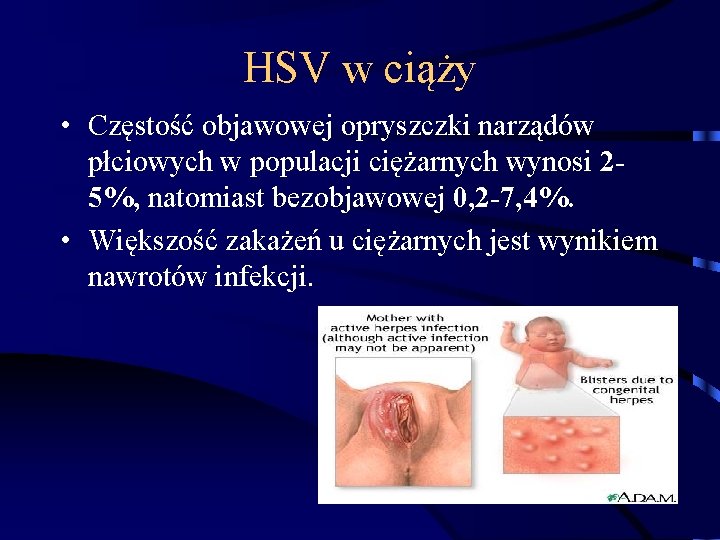 HSV w ciąży • Częstość objawowej opryszczki narządów płciowych w populacji ciężarnych wynosi 25%,