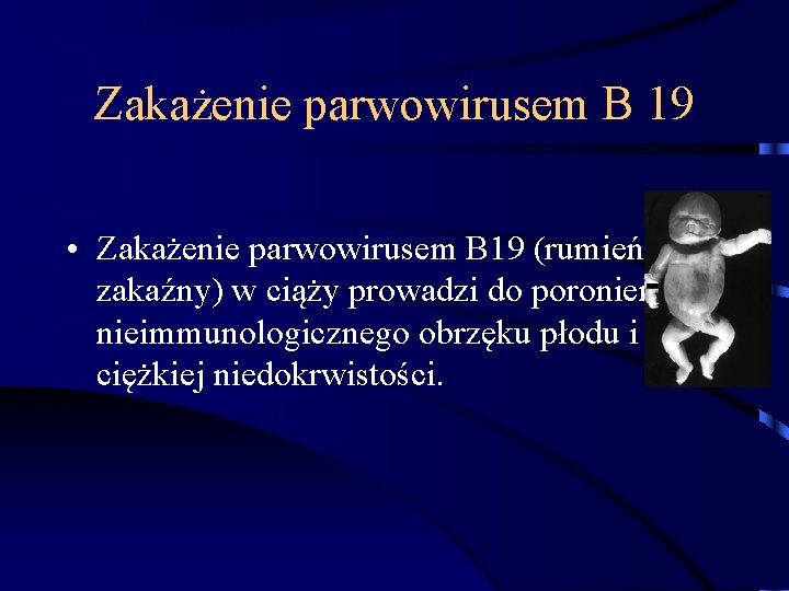 Zakażenie parwowirusem B 19 • Zakażenie parwowirusem B 19 (rumień zakaźny) w ciąży prowadzi