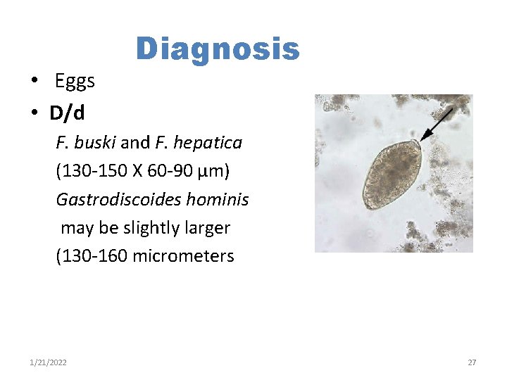  • Eggs • D/d Diagnosis F. buski and F. hepatica (130 -150 X