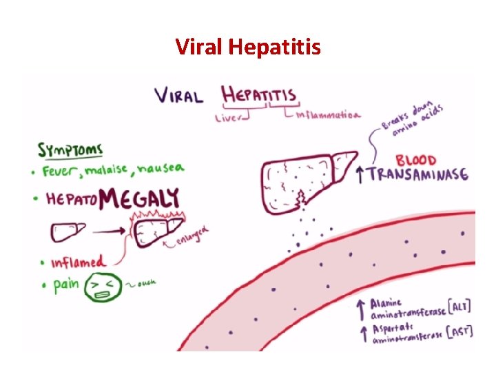 Viral Hepatitis 