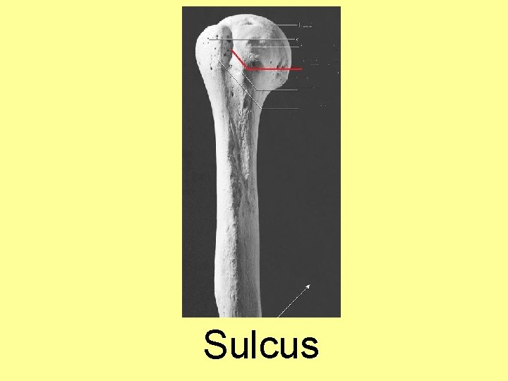 Sulcus 