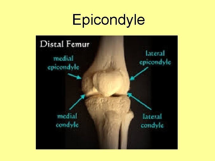 Epicondyle 