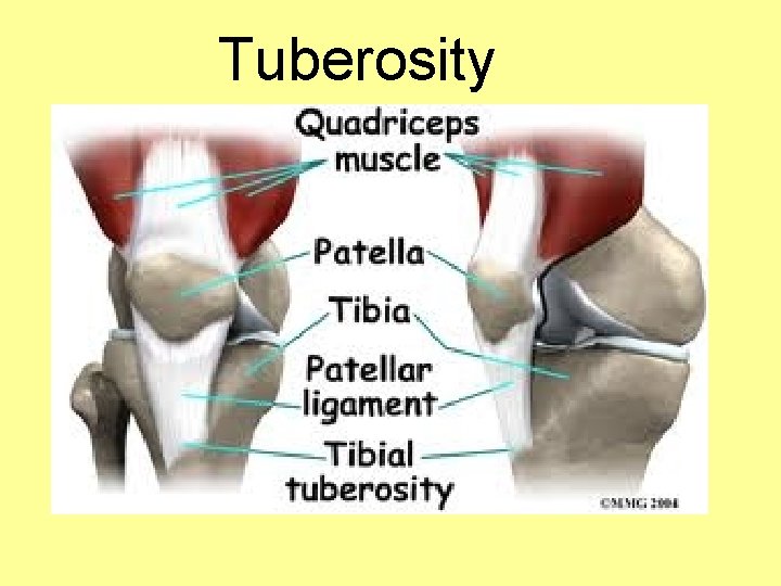 Tuberosity 