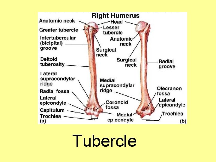 Tubercle 