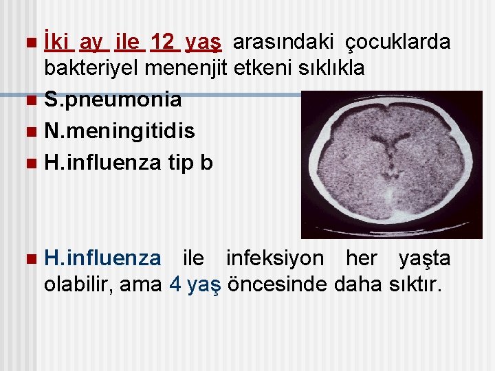 İki ay ile 12 yaş arasındaki çocuklarda bakteriyel menenjit etkeni sıklıkla n S. pneumonia