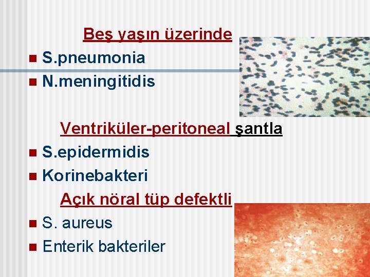 Beş yaşın üzerinde n S. pneumonia n N. meningitidis Ventriküler-peritoneal şantla n S. epidermidis