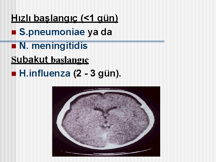 Hızlı başlangıç (<1 gün) n S. pneumoniae ya da n N. meningitidis Subakut başlangıç
