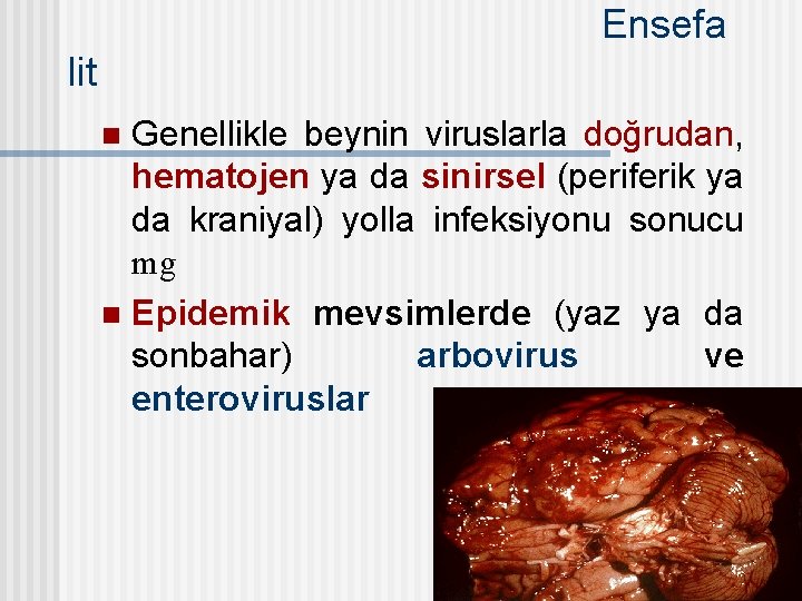 Ensefa lit Genellikle beynin viruslarla doğrudan, hematojen ya da sinirsel (periferik ya da kraniyal)