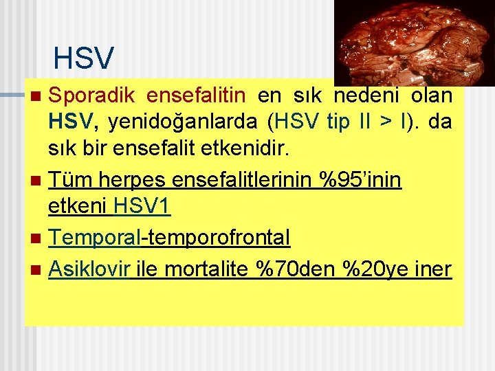 HSV Sporadik ensefalitin en sık nedeni olan HSV, yenidoğanlarda (HSV tip II > I).