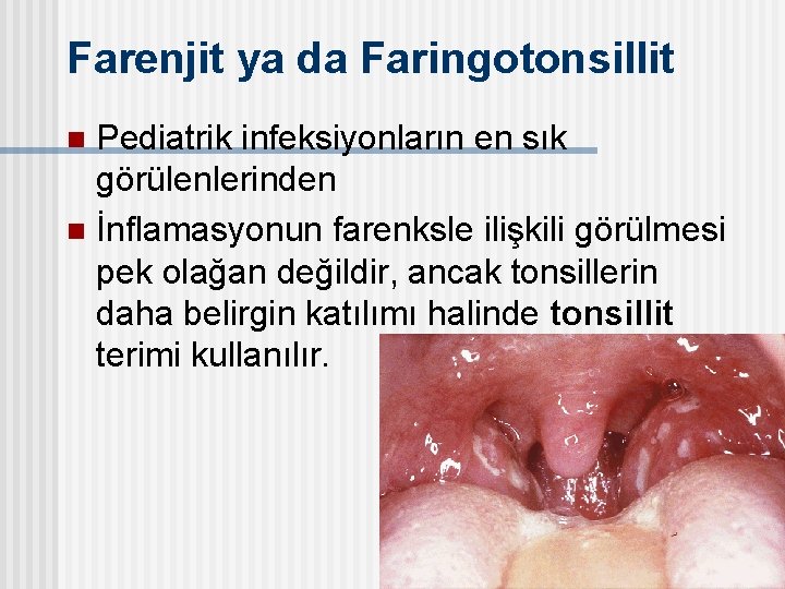 Farenjit ya da Faringotonsillit Pediatrik infeksiyonların en sık görülenlerinden n İnflamasyonun farenksle ilişkili görülmesi