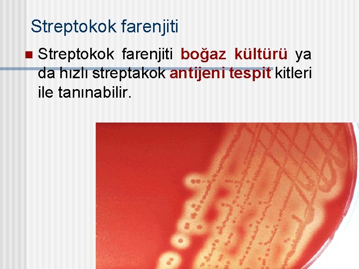 Streptokok farenjiti n Streptokok farenjiti boğaz kültürü ya da hızlı streptakok antijeni tespit kitleri