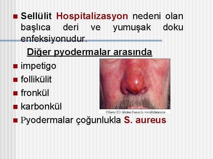 Sellülit Hospitalizasyon nedeni olan başlıca deri ve yumuşak doku enfeksiyonudur. Diğer pyodermalar arasında n