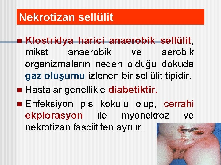 Nekrotizan sellülit Klostridya harici anaerobik sellülit, mikst anaerobik ve aerobik organizmaların neden olduğu dokuda