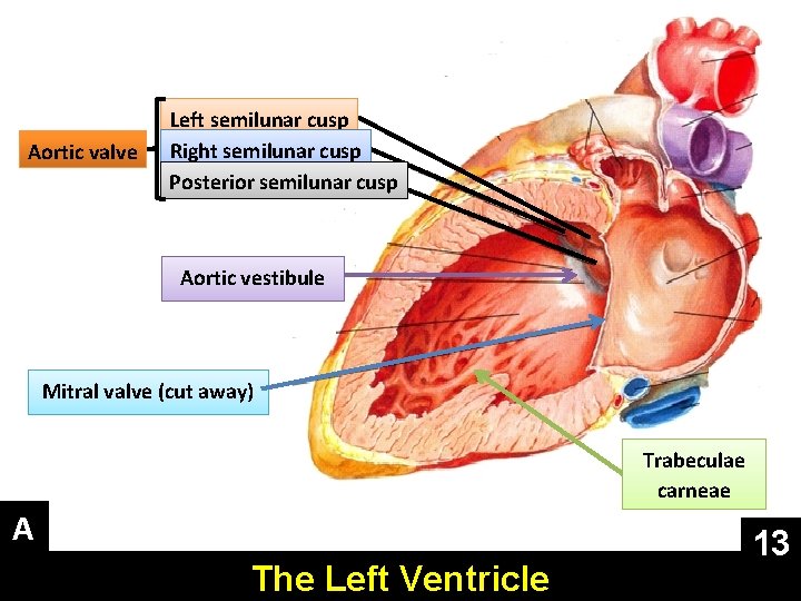 Aortic valve Left semilunar cusp Right semilunar cusp Posterior semilunar cusp Aortic vestibule Mitral