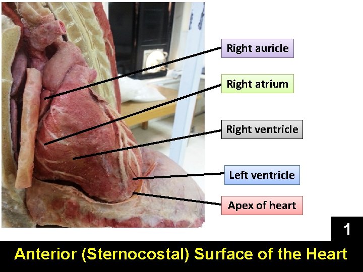 Right auricle Right atrium Right ventricle Left ventricle Apex of heart 1 Anterior (Sternocostal)