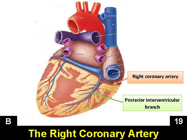 Right coronary artery Posterior interventricular branch B 19 The Right Coronary Artery 