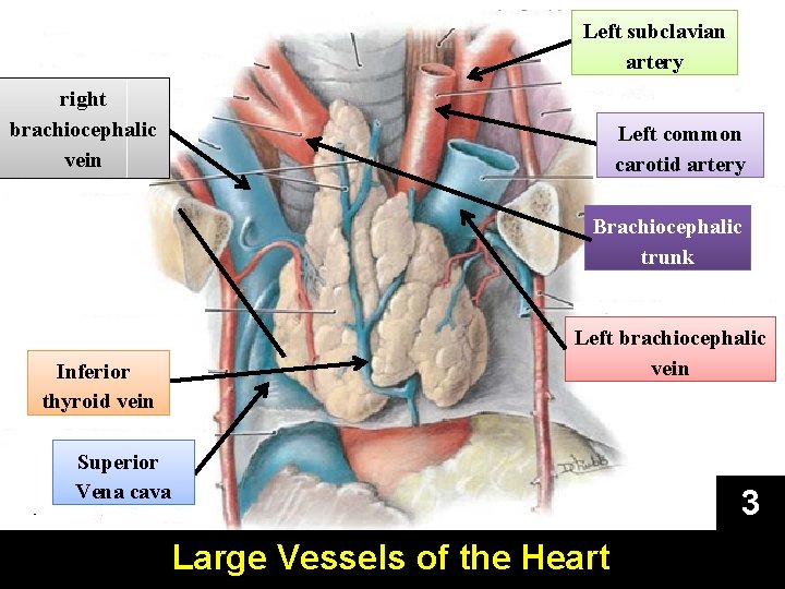 Left subclavian artery right brachiocephalic vein Left common carotid artery Brachiocephalic trunk Inferior thyroid
