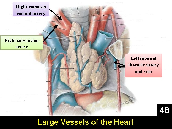 Right common carotid artery Right subclavian artery Left internal thoracic artery and vein 4