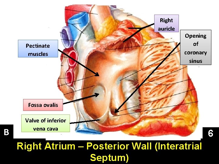 Right auricle Pectinate muscles Opening of coronary sinus Fossa ovalis B Valve of inferior