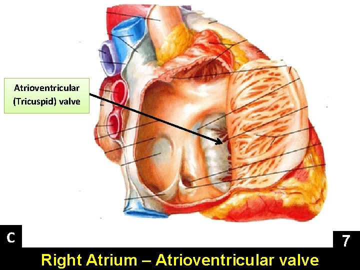 Atrioventricular (Tricuspid) valve C 7 Right Atrium – Atrioventricular valve 