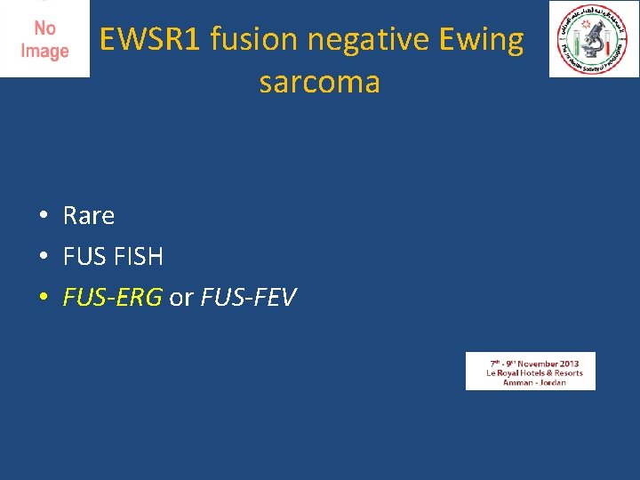 EWSR 1 fusion negative Ewing sarcoma • Rare • FUS FISH • FUS-ERG or