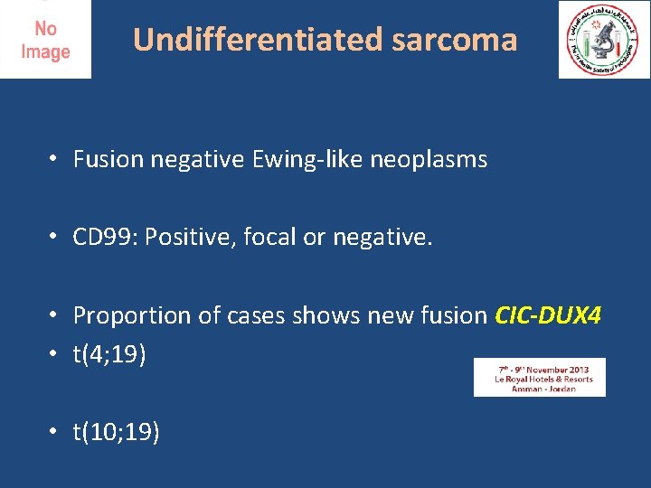 Undifferentiated sarcoma • Fusion negative Ewing-like neoplasms • CD 99: Positive, focal or negative.