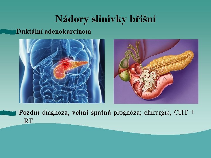 Nádory slinivky břišní Duktální adenokarcinom Pozdní diagnoza, velmi špatná prognóza; chirurgie, CHT + RT