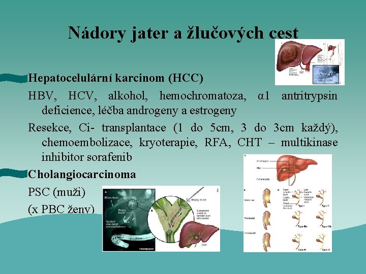 Nádory jater a žlučových cest Hepatocelulární karcinom (HCC) HBV, HCV, alkohol, hemochromatoza, α 1