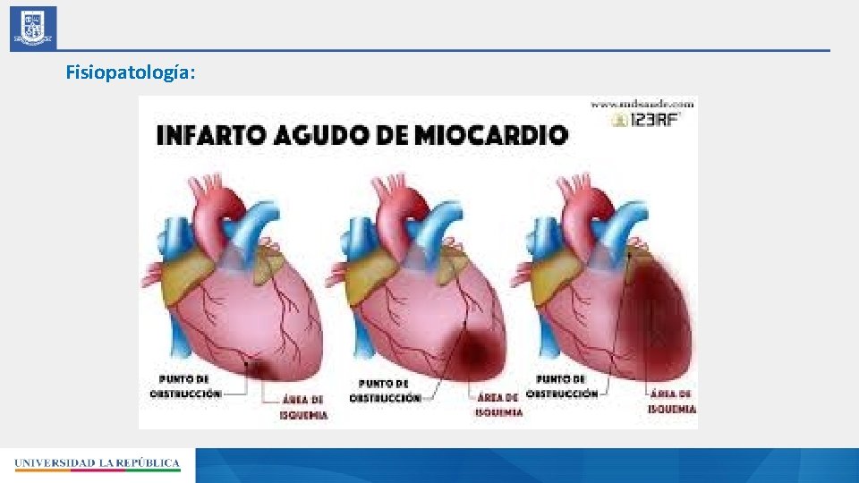 Fisiopatología: 