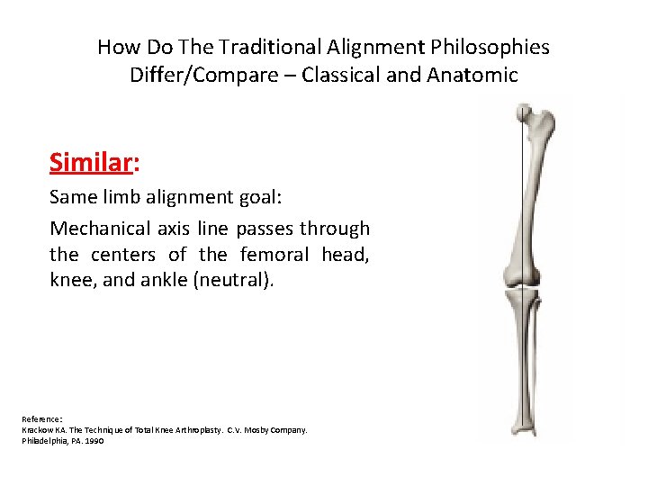 How Do The Traditional Alignment Philosophies Differ/Compare – Classical and Anatomic Similar: Same limb