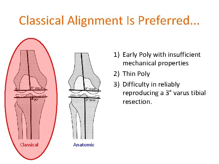 Classical Alignment Is Preferred. . . 1) Early Poly with insufficient mechanical properties 2)