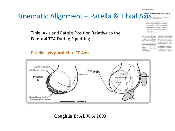 Kinematic Alignment – Patella & Tibial Axis and Patella Position Relative to the Femoral